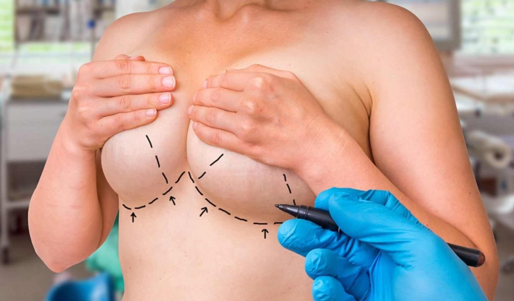 Операция по уменьшению груди в Краснодарском крае